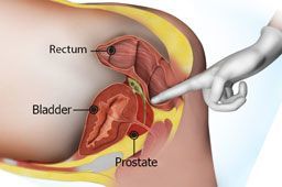 Screening & Diagnosis