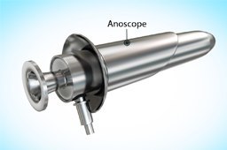 anoscope